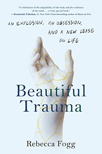 cover image Beautiful Trauma: An Explosion, an Obsession, and a New Lease on Life